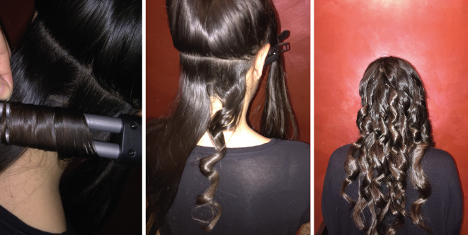 Depilaci&oacute;n laser