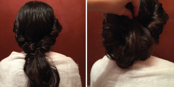 Depilaci&oacute;n laser