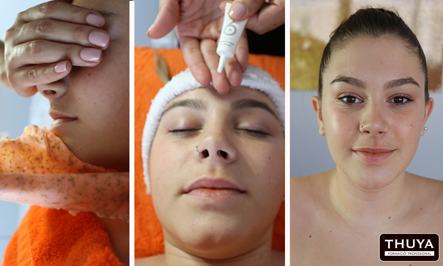 tratamientoestetica4