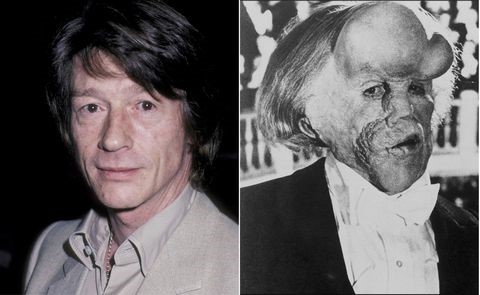 David Lynch - El hombre elefante (1980)