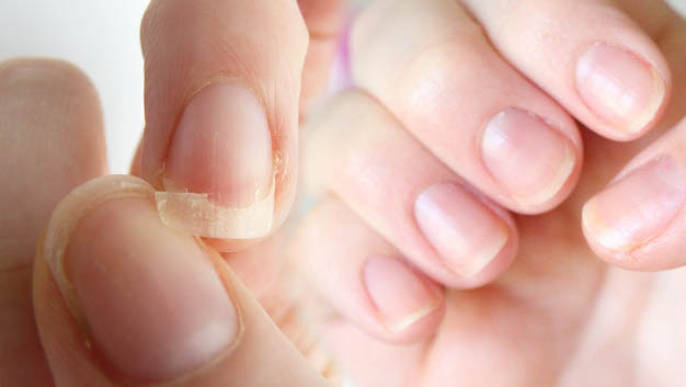 u&ntilde;a en descomposici&oacute;n