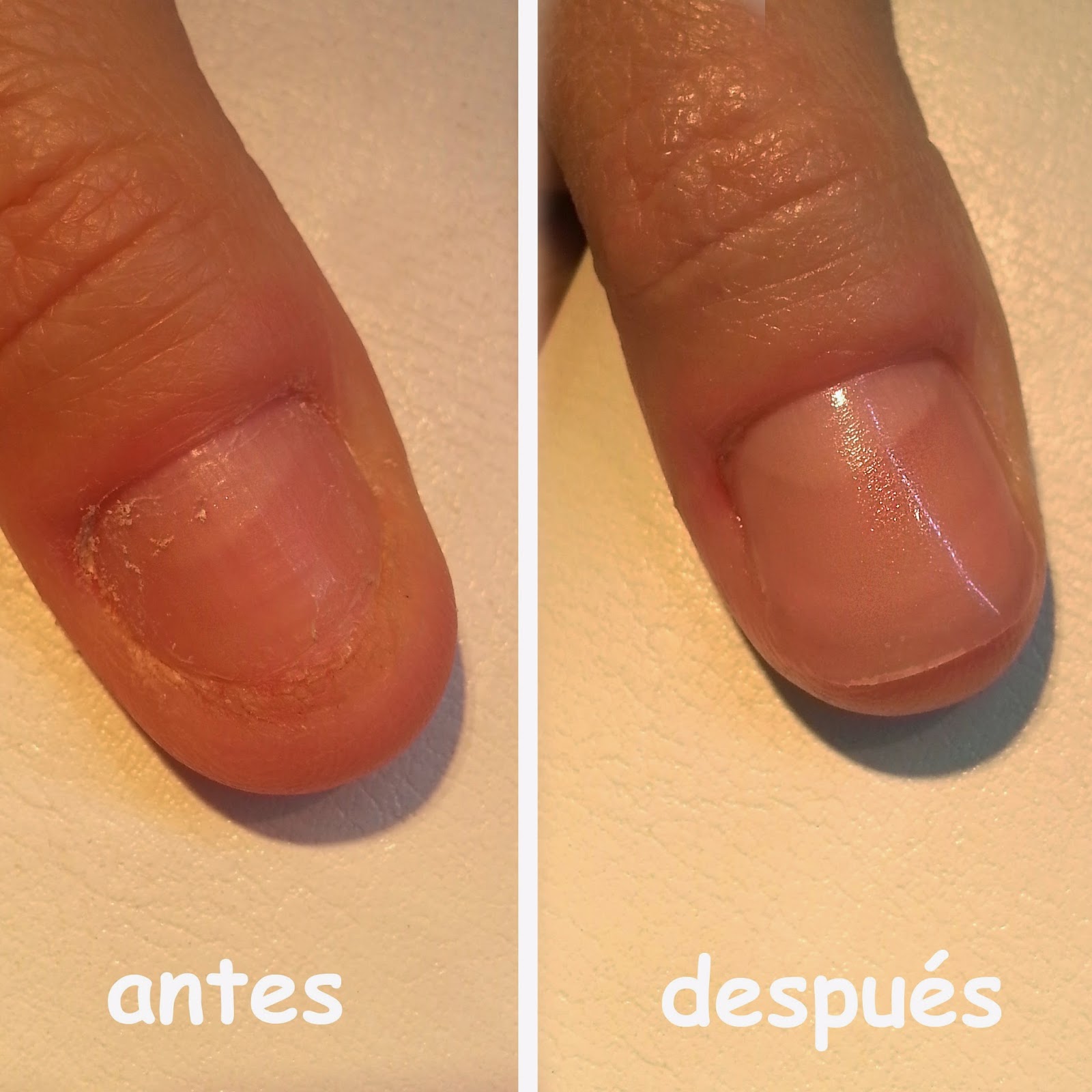 u&ntilde;as mordidas