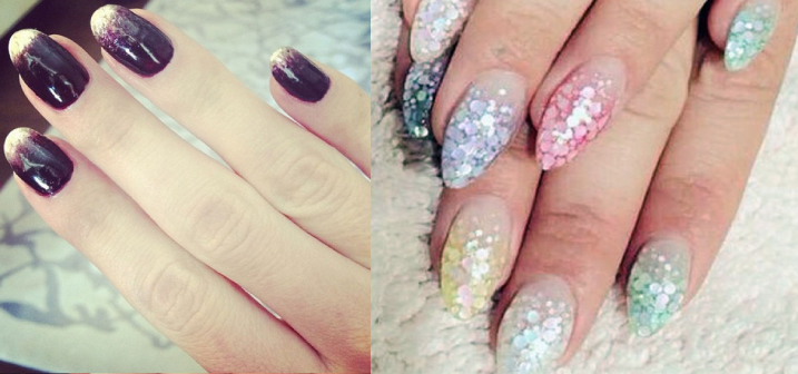 depilaci&oacute;n laser