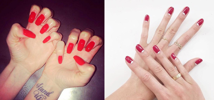 depilaci&oacute;n laser