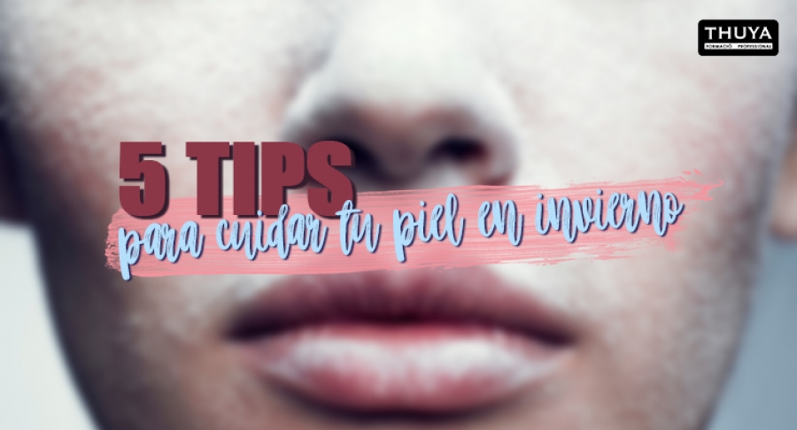 Tips para cuidar tu piel en invierno