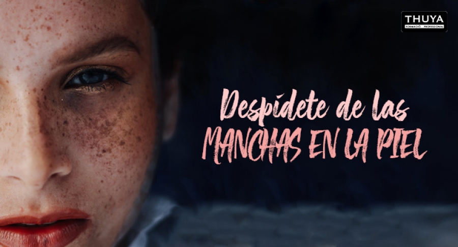 Despídete de las manchas en la piel